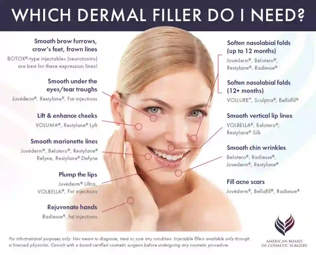 Cosmetic Filler Treatment Areas by Filler Type