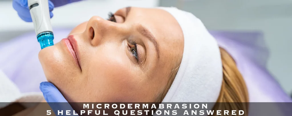 MICRODERMABRASION - 5 HELPFUL QUESTIONS ANSWERED