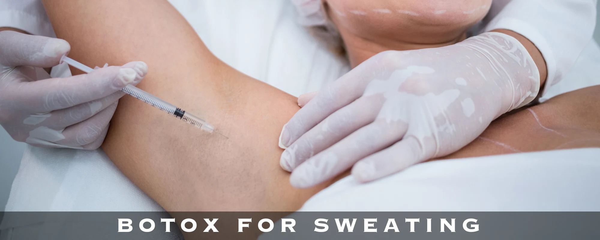BOTOX FOR SWEATING