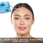 8. HOW DOES BOTOX REMOVE® WRINKLES?