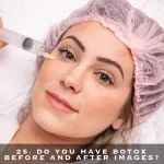 25. DO YOU HAVE BOTOX BEFORE AND AFTER IMAGES?
