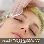 17. HOW MANY JUVÉDERM FILLER INJECTIONS WILL I NEED?