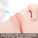 18. WHAT ARE THE COMMON SIDE EFFECTS OF JUVÉDERM FILLER INJECTIONS?