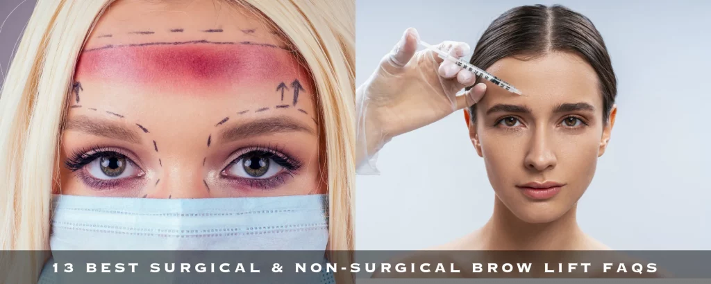 13 BEST SURGICAL & NON-SURGICAL BROW LIFT FAQS
