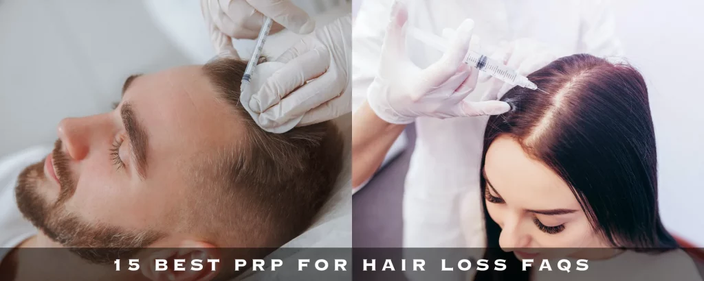 15 BEST PRP FOR HAIR LOSS FAQS