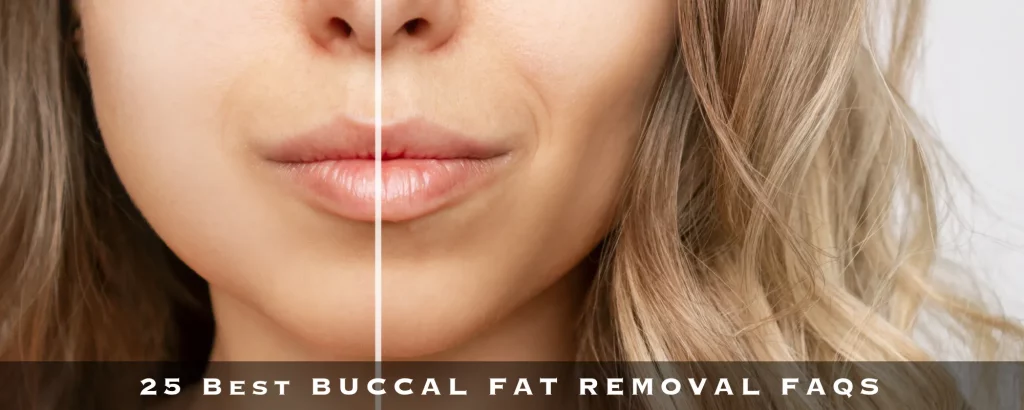 25 BEST BUCCAL FAT REMOVAL FAQS