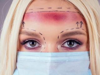HOW LONG DOES IT TAKE FOR BROW LIFT SURGERY? (BROW LIFT FAQ)