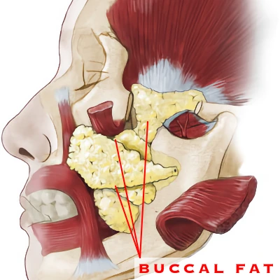BUCCAL FAT PAD DIAGRAM