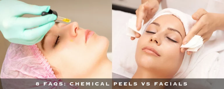 8 FAQs – Chemical Peels Vs Facials
