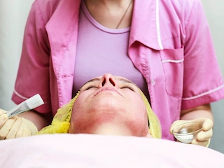 2. WHAT IS THE PROCEDURE DIFFERENCES BETWEEN A CHEMICAL PEEL AND A FACIAL?