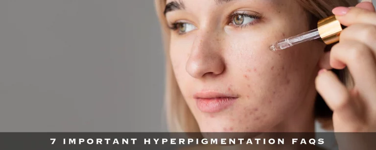 7 Important Hyperpigmentation FAQs (2022)