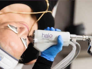 WHAT IS HALO LASER?