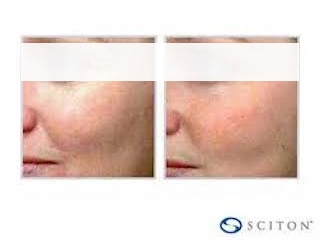 WHAT SKIN TYPES CAN CONTOUR TRL TREAT?