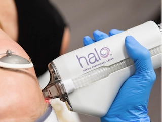 IS HALO LASER BETTER THAN BOTOX?