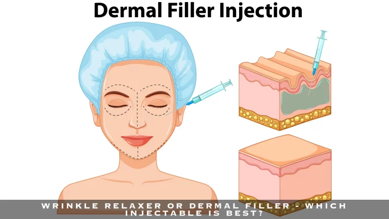 WRINKLE RELAXER OR DERMAL FILLER - WHICH INJECTABLE IS BEST?