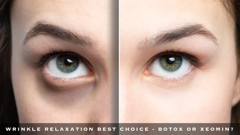 WRINKLE RELAXATION BEST CHOICE - BOTOX OR XEOMIN?