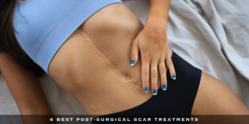 6 BEST POST-SURGICAL SCAR TREATMENTS