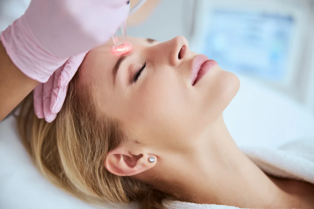 Laser skin resurfacing procedure in progress.