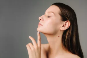 Side view of woman showing defined jawline after Botox Nefertiti lift.